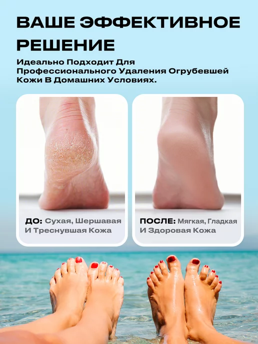 pritech Электрическая пилка для пяток мощная аппарат для педикюра, белый, фото 7