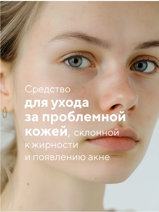 Pharmlevel Лосьон для проблемной кожи от прыщей и акне 100мл 2шт, 100 мл, 2 шт, фото 2