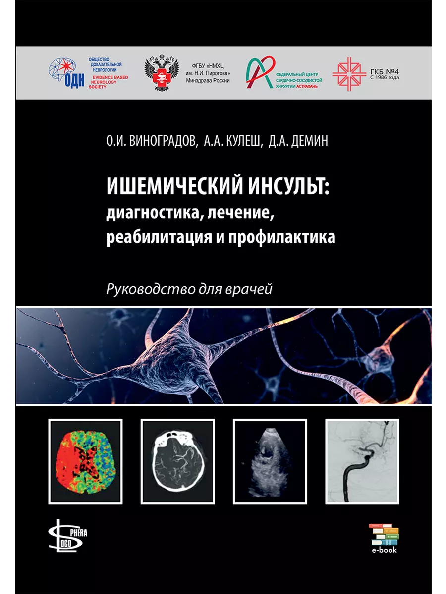 Ишемический инсульт диагностика, лечение, реабилитация