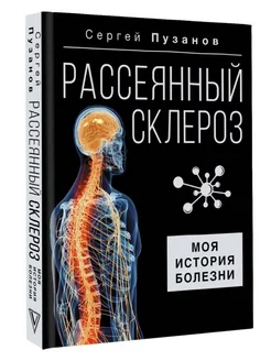 Рассеянный склероз. Моя история болезни