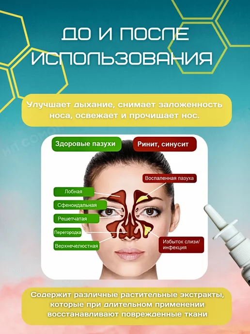 NatureProduct Капли в нос спрей китайский от насморка с прополисом 2шт, вариант, фото 3