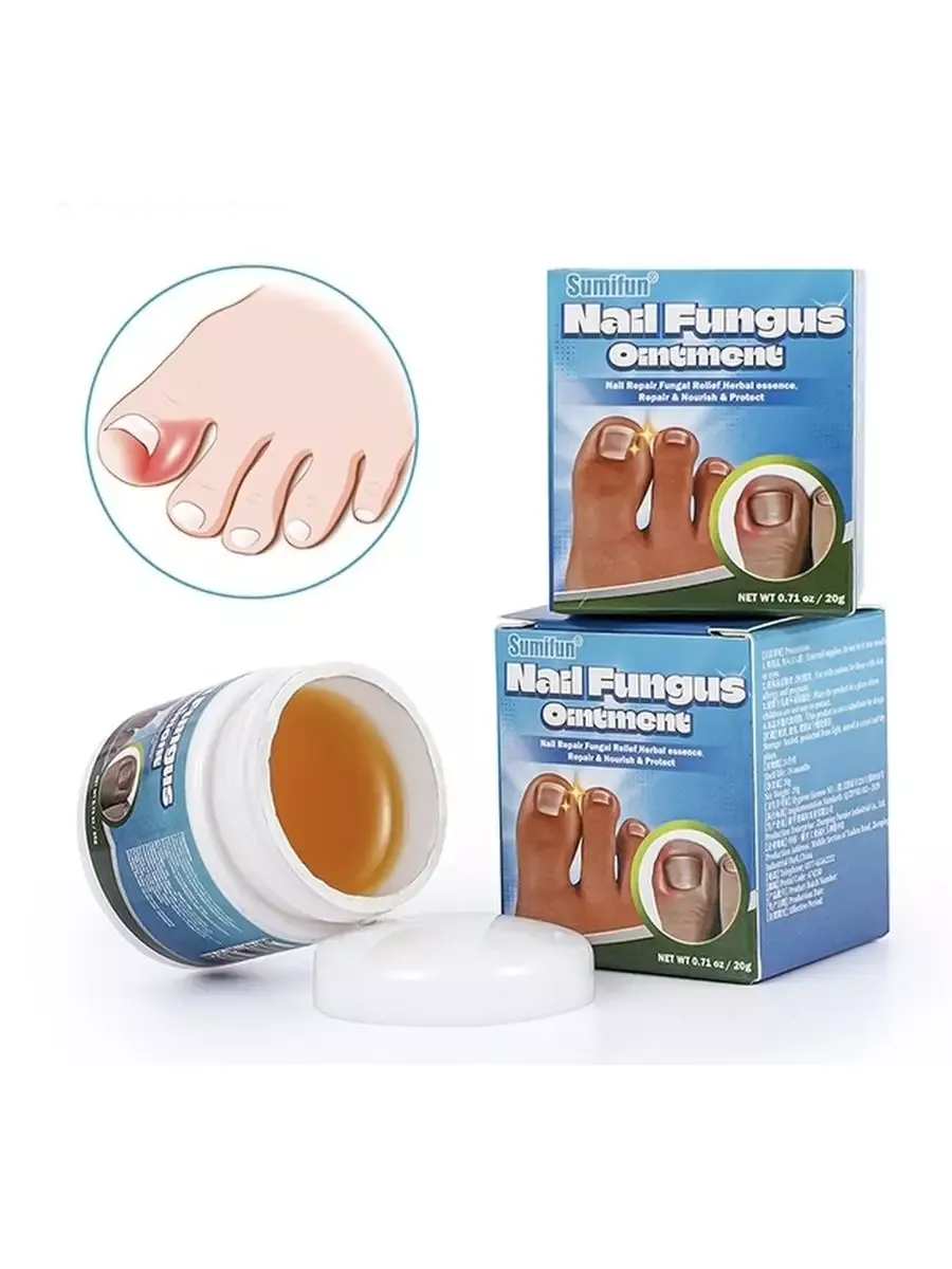 Препарат экзолоцин от грибка. Недорогую мазь от грибка ногтей отзывы. Средство от грибка ногтей. Мазь для восстановления. Мазь против грибка ногтей на ногах.