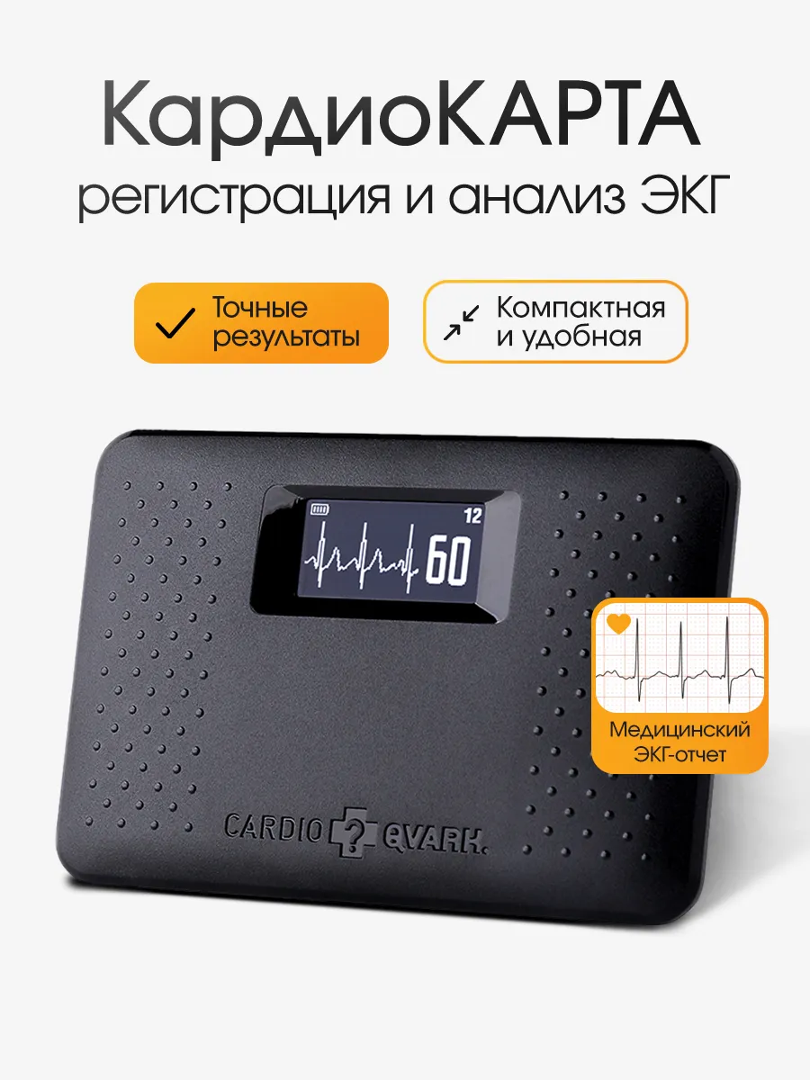 КардиоКАРТА система мониторинга ЭКГ, Кардио карта
