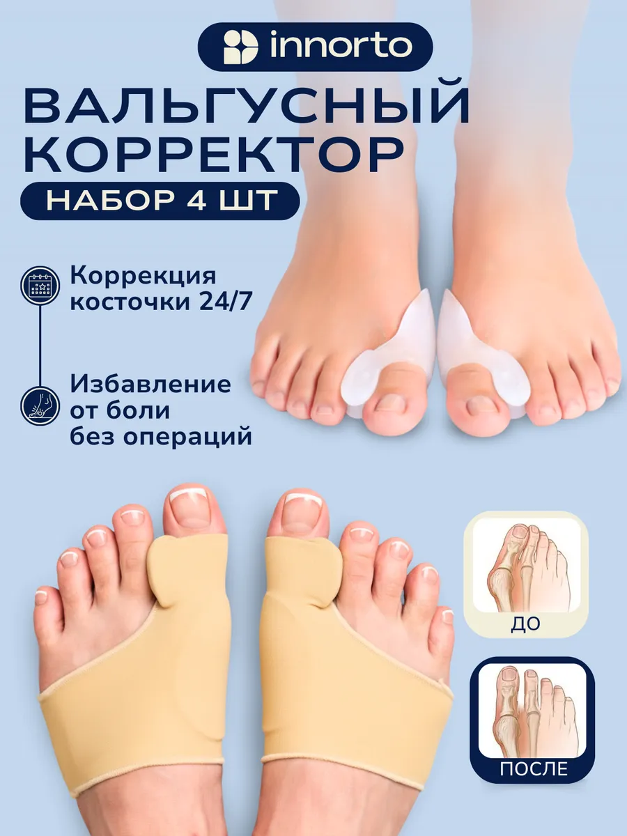 Вальгусный корректор большого пальца