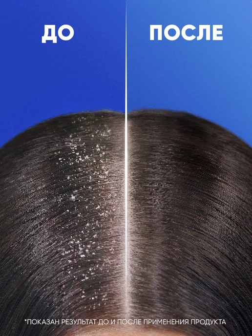Head & Shoulders Шампунь для волос мужской Комплексный уход 600 мл, 600 мл, фото 5