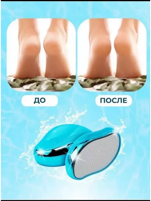 Пемза для ног/Терка лазерная для ног/Педикюр Нано терка для ног и пяток, голубой, фото 2