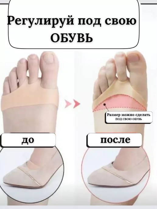 WKUB Подушечки под стопу дышащие гелевые стельки для обуви, вариант, фото 2