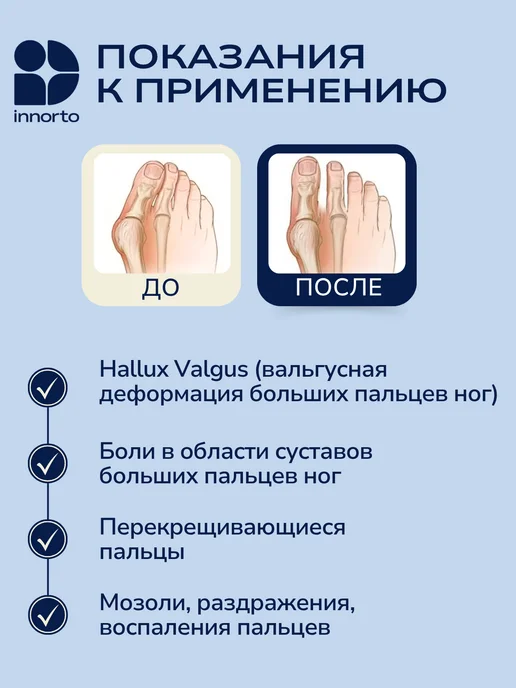 INNORTO Разделитель большого пальца, белый, фото 2