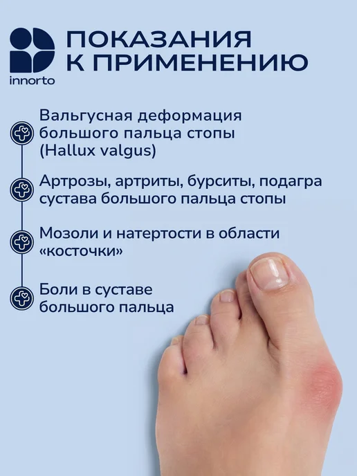 INNORTO Вальгусный корректор большого пальца с разделителем, вариант, фото 2