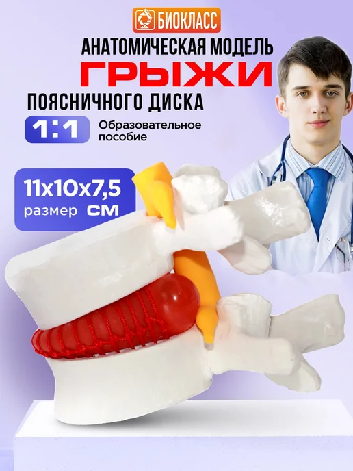 БИОКЛАСС Анатомическая модель грыжи поясничного диска 1 1, вариант