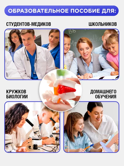 БИОКЛАСС Анатомическая модель грыжи поясничного диска 1 1, вариант, фото 4