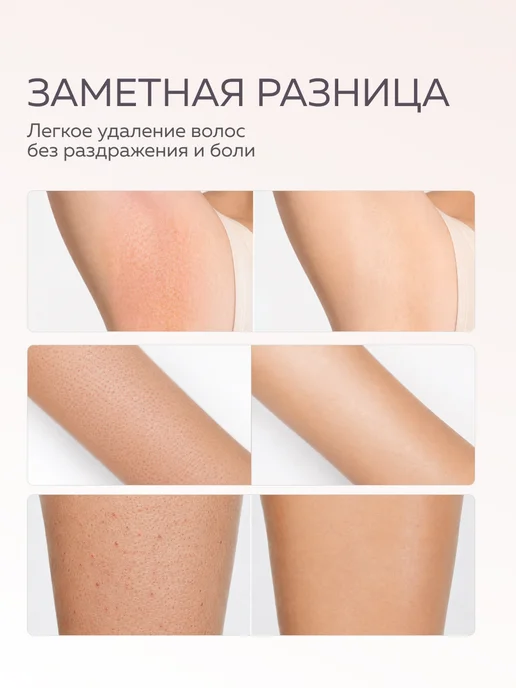 Fito cosmetic Мусс- пена для бритья женская для чувствительной кожи, вариант, фото 3