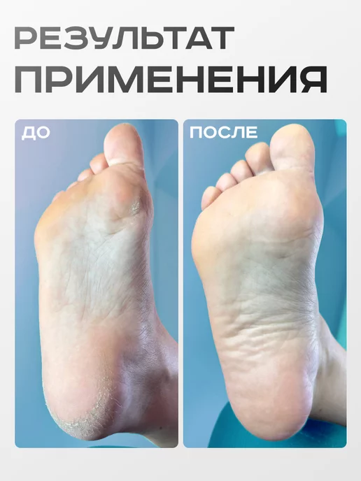 ELNAIL PRO Сменные файлы для педикюра SOFT M 180 грит Push Up, 50 шт, фото 4