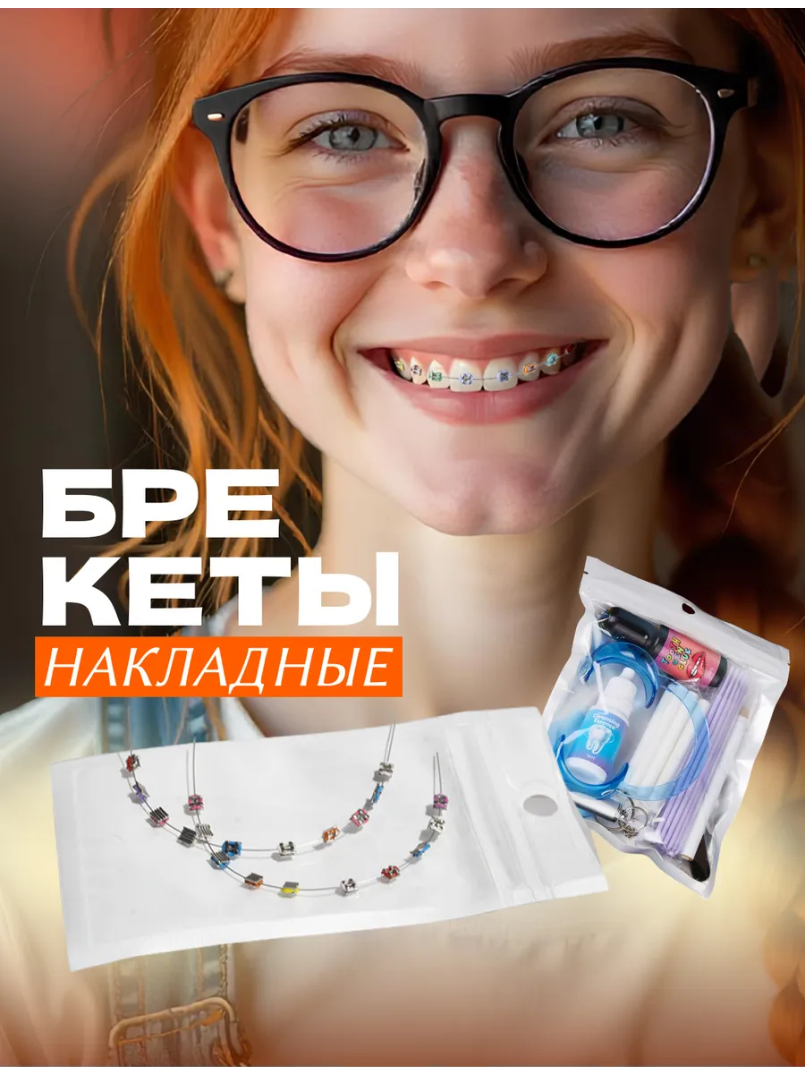 Брекеты накладные съемные