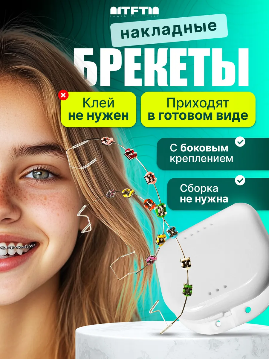 Накладные брекеты на зубы