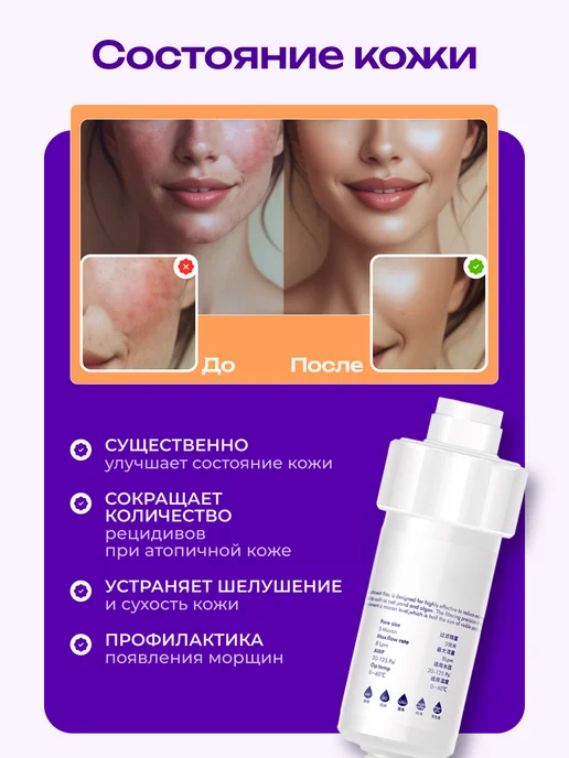 LIVENTO Картридж для фильтра для душа от хлора и ржавчины 4 шт, 4 шт, фото 3