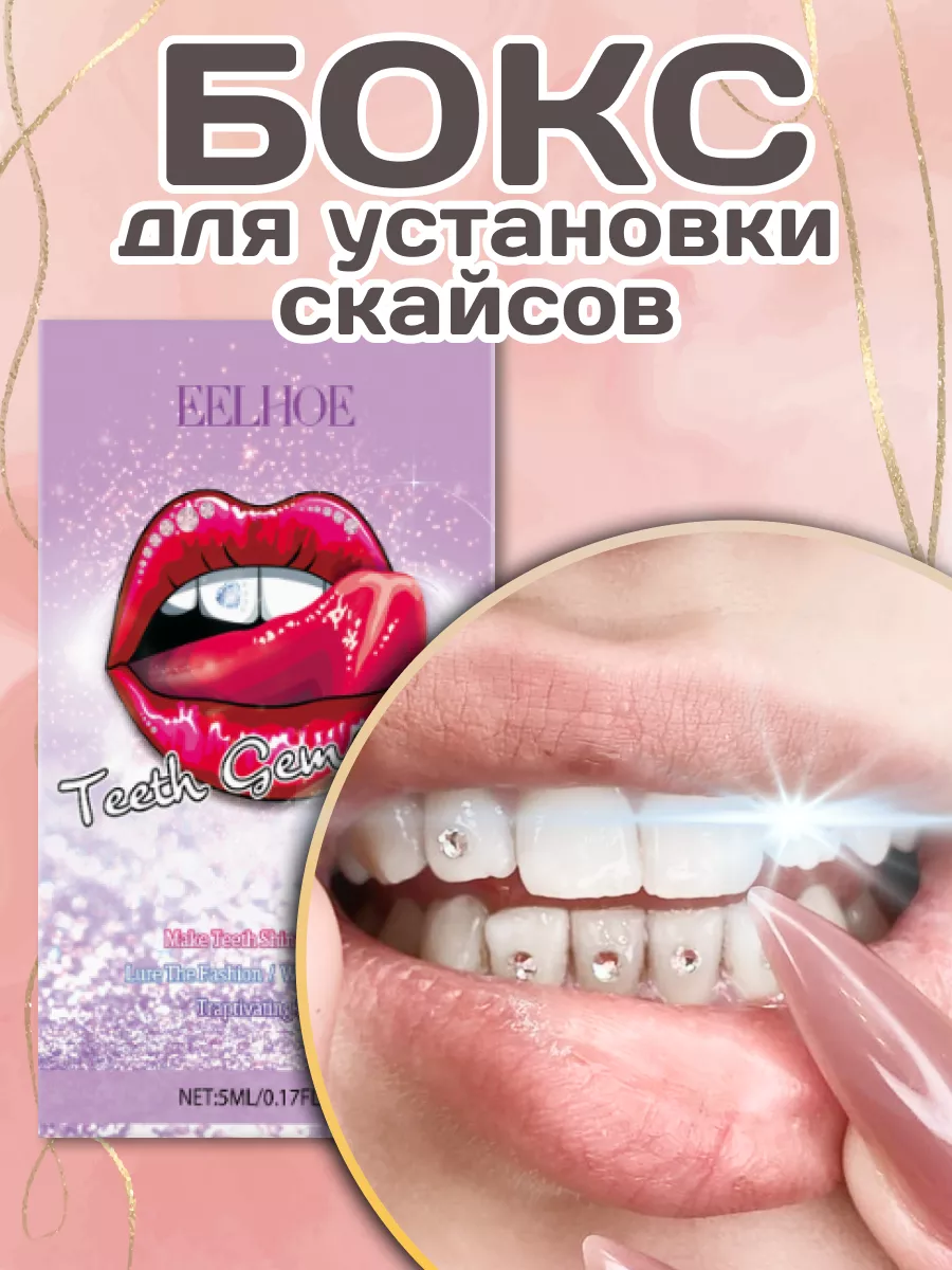 скайсы бокс для установки...