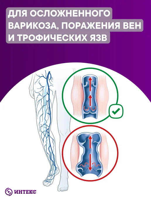 Интекс Бинт эластичный низкой растяжимости 1м х 8см 2 шт, 1 м, 2 шт, фото 2