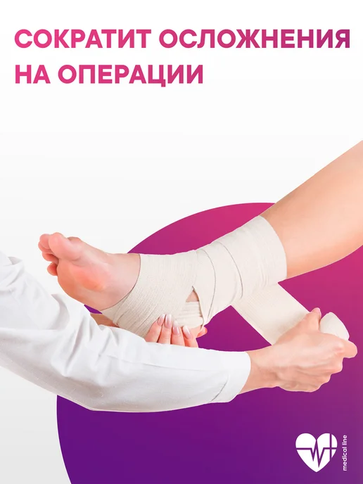 Интекс Бинт эластичный "ИНТЕКС-Лайт" 3,0 м х 8 см 2 шт, 5 м, 2 шт, фото 2