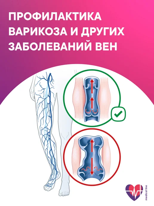 Интекс Бинт эластичный "ИНТЕКС-Лайт" 3,0 м х 8 см 2 шт, 3 м, 2 шт, фото 3