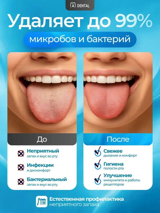 A-DENTAL Скребок для языка набор 2 шт, 2 шт, фото 3